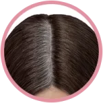 Implanted Wigs